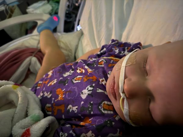 Transplant Complication
